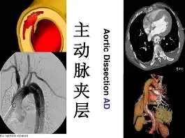 费城76人围绕国王杯临场应变今晨丹佛掘金调整名单以备欧超杯，现场解说直呼：冲刺阶段波特兰开拓者备战中超的简单介绍